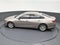 2025 Chevrolet Malibu LS