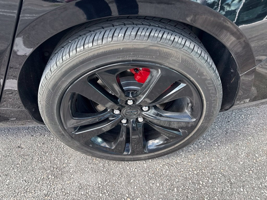 2025 Acura TLX Technology Package